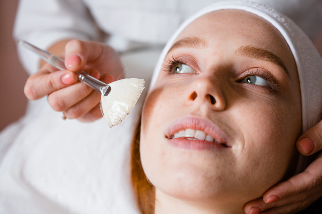 chemische-peeling